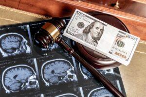 Medical scan of a brain injury with a judge’s gavel and $100 indicating how much a brain injury settlement is worth.